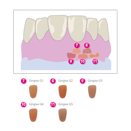 Nexco Paste Gingiva 2.5g G1