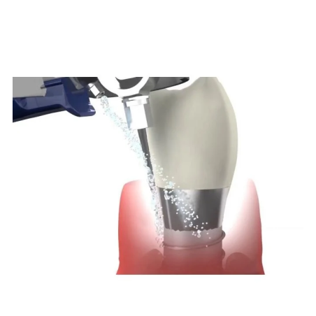 Aparat parodontologie Vector Paro Pro - Durr Dental