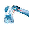 Aparat parodontologie Vector Paro Pro - Durr Dental