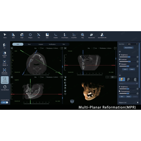 FinScan F350 CBCT Unit fara CEPH