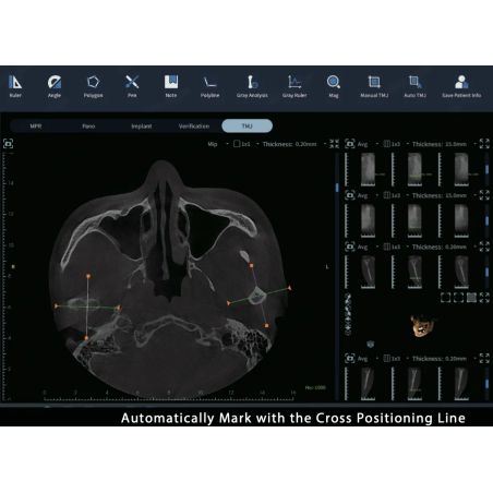 FinScan F350 CBCT Unit fara CEPH