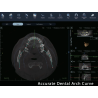 FinScan F350 CBCT Unit fara CEPH