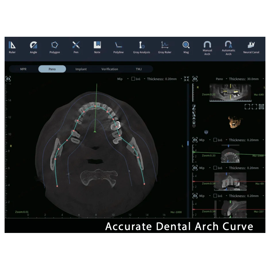 FinScan F350 CBCT Unit fara CEPH