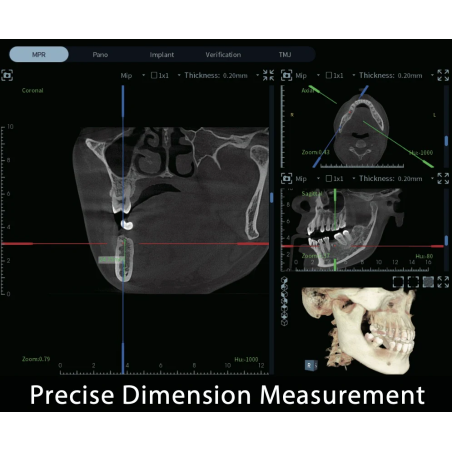 FinScan F350 CBCT Unit fara CEPH