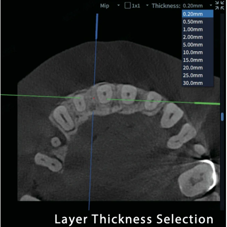 FinScan F350 CBCT Unit fara CEPH