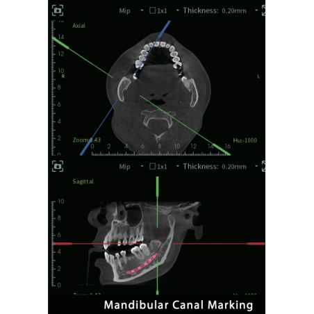 FinScan F350 CBCT Unit fara CEPH