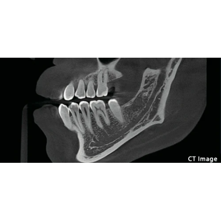 FinScan F350 CBCT Unit fara CEPH