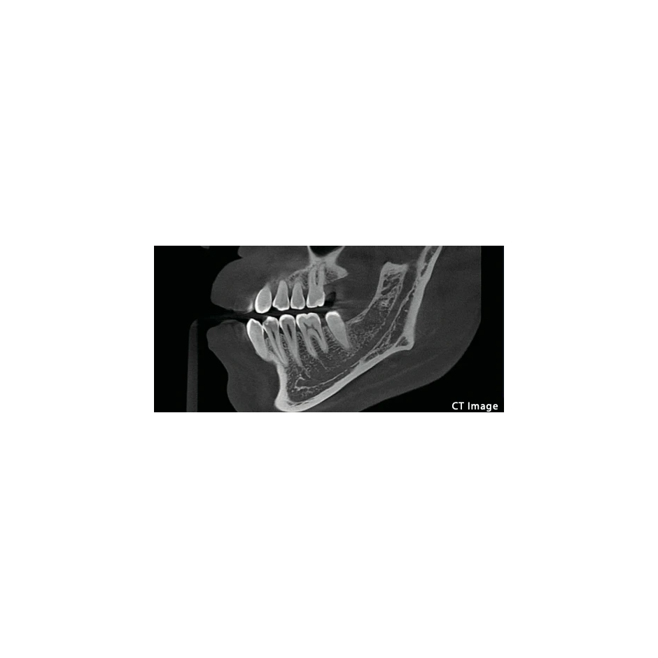 FinScan F350 CBCT Unit fara CEPH