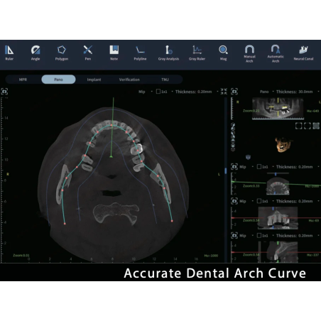 FinScan F350 CBCT Unit fara CEPH