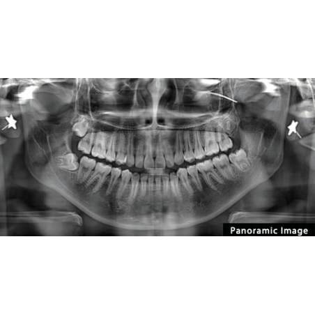FinScan F350 CBCT Unit fara CEPH