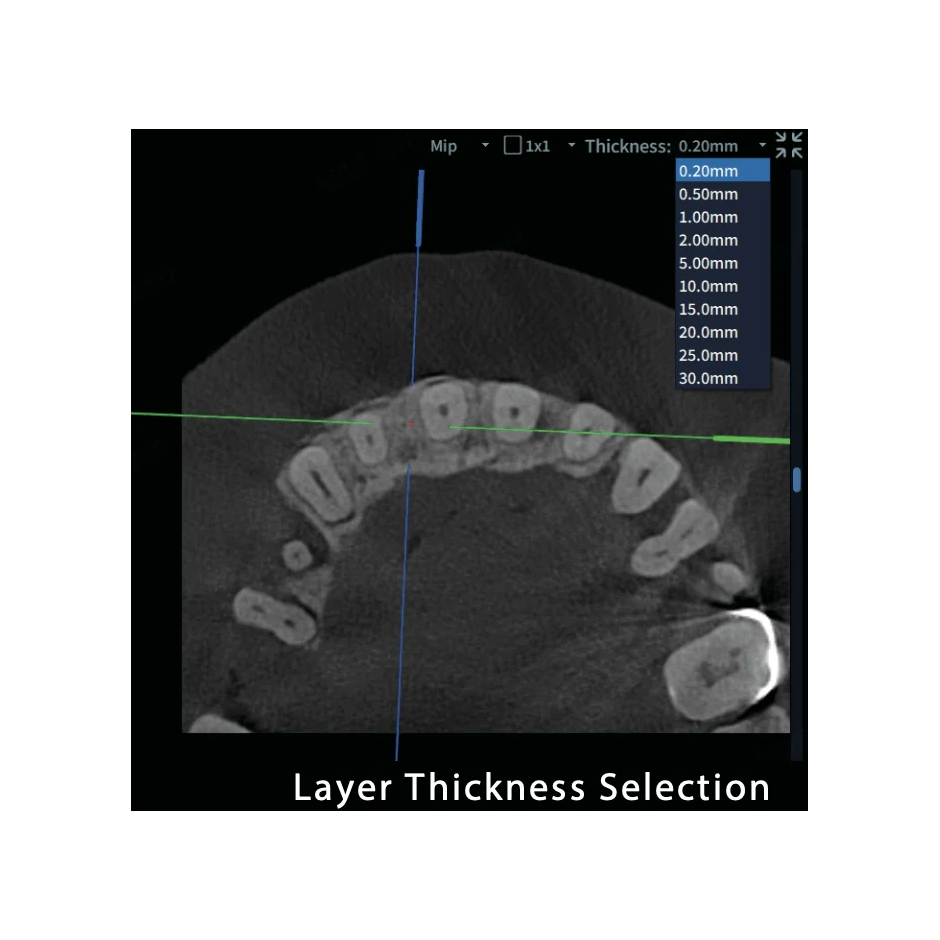 FinScan F350 CBCT Unit fara CEPH