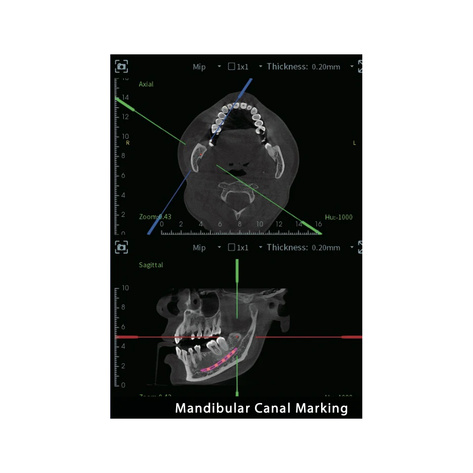 FinScan F350 CBCT Unit fara CEPH