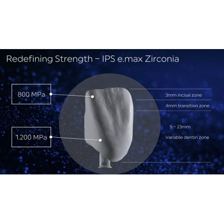 e.max Zirconia B1 12mm