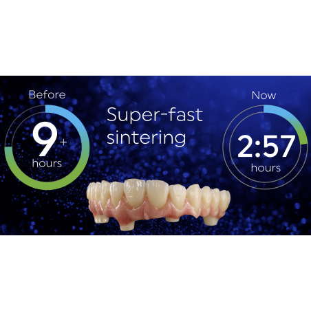 e.max Zirconia B1 12mm
