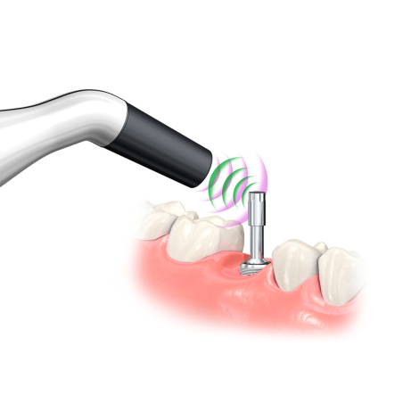 PENGUIN II INSTRUMENT MASURARE STABILITATE IMPLANT