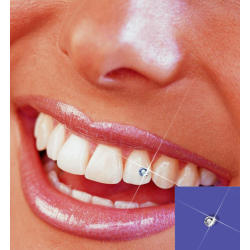 Bijuterii dentare Skyce...