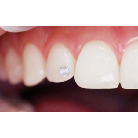 Bijuterii dentare Skyce 1.9mm Crystal