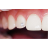 Bijuterii dentare Skyce 1.9mm Crystal