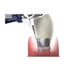 Aparat parodontologie Vector Paro Pro III - Durr Dental