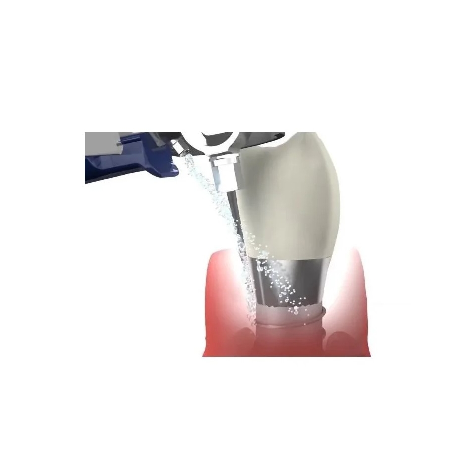 Aparat parodontologie Vector Paro Pro III - Durr Dental