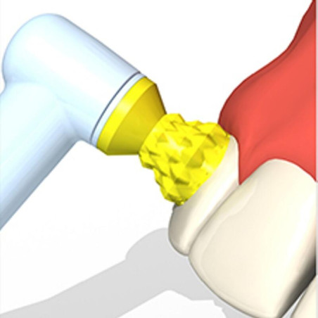 GUME PROFILAXIE NETEDE SOFT - LIME 1buc 